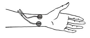 rtemagicc_elektroden-beck-jpg